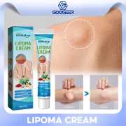 1 pcs / Lipoma Removal Cream-লাইপোমা রিমুভাল ক্রিম