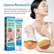 Lipoma Removal Cream-লাইপোমা রিমুভাল ক্রিম 3 (২ পিস নিলে ১ পিস ফ্রি)